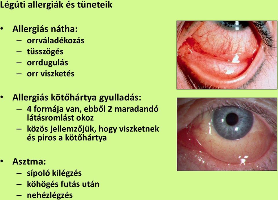 ebből 2 maradandó látásromlást okoz közös jellemzőjük, hogy viszketnek