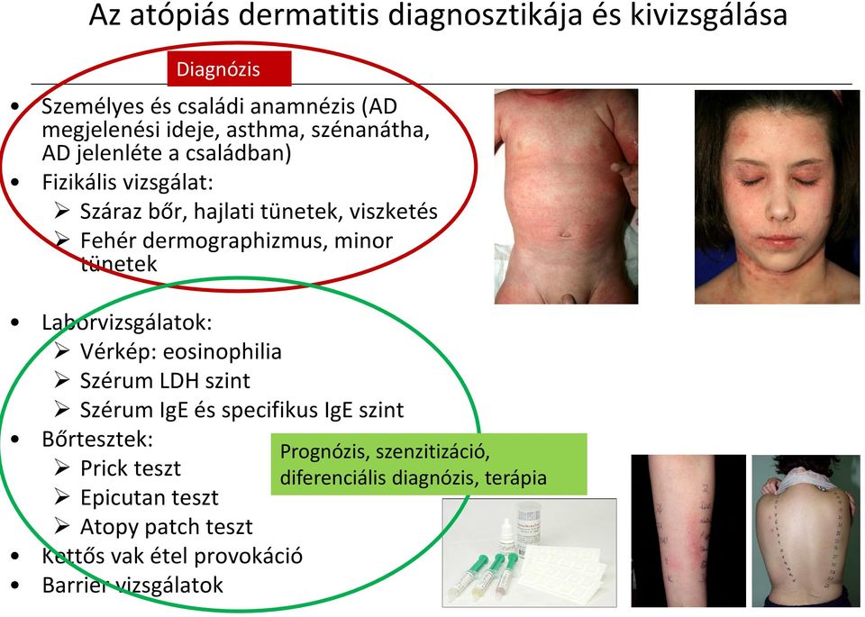 tünetek Laborvizsgálatok: Vérkép: eosinophilia Szérum LDH szint Szérum IgE és specifikus IgE szint Bőrtesztek: Prognózis,