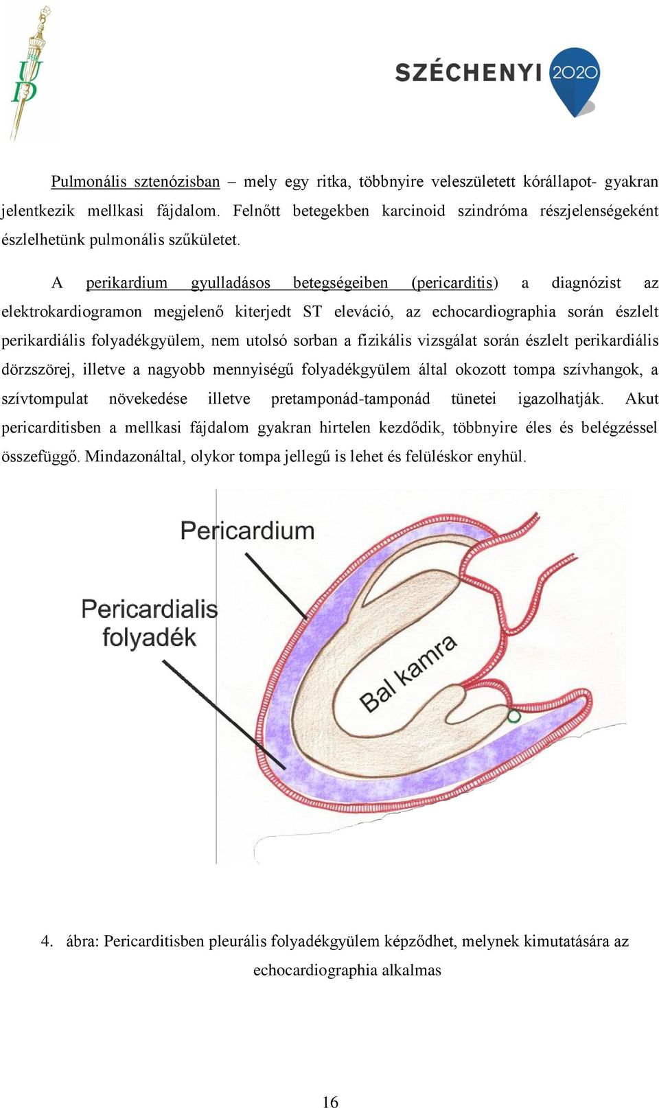 A perikardium gyulladásos betegségeiben (pericarditis) a diagnózist az elektrokardiogramon megjelenő kiterjedt ST eleváció, az echocardiographia során észlelt perikardiális folyadékgyülem, nem utolsó