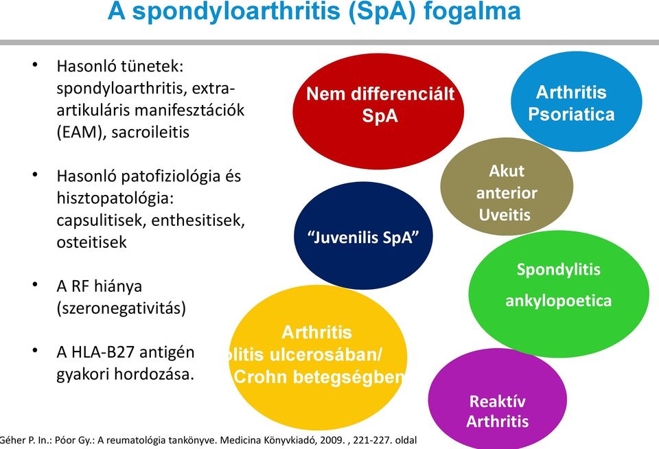 Uveitis Juvenilis SpA A RF hiánya (szeronegativitás) Spondylitis ankylopoetica Arthritis A HLA-B27 antigén colitis ulcerosában/