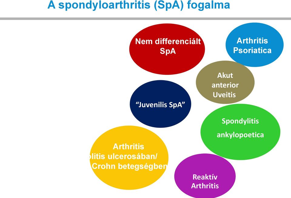 Uveitis Juvenilis SpA Spondylitis ankylopoetica