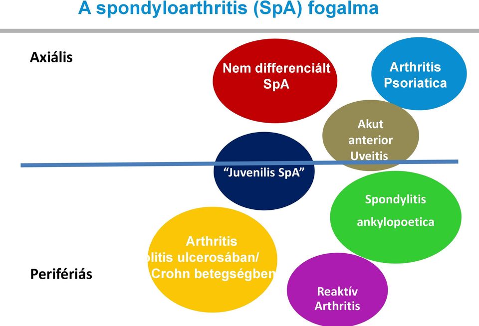 Juvenilis SpA Spondylitis ankylopoetica Perifériás