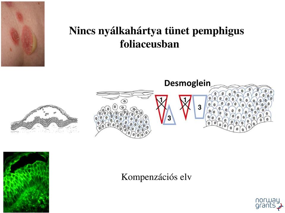 foliaceusban