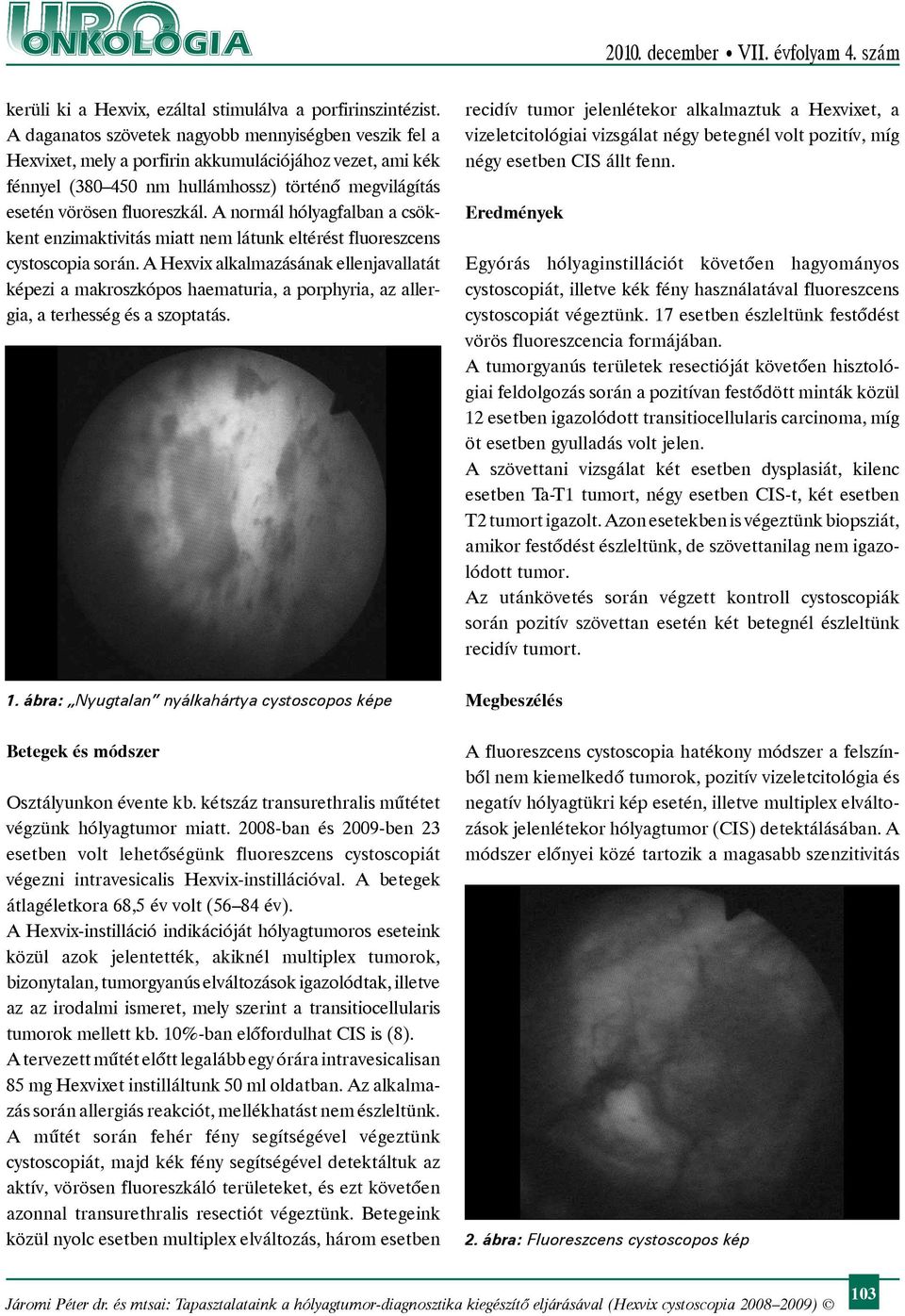 A normál hólyagfalban a csökkent enzimaktivitás miatt nem látunk eltérést fluoreszcens cystoscopia során.