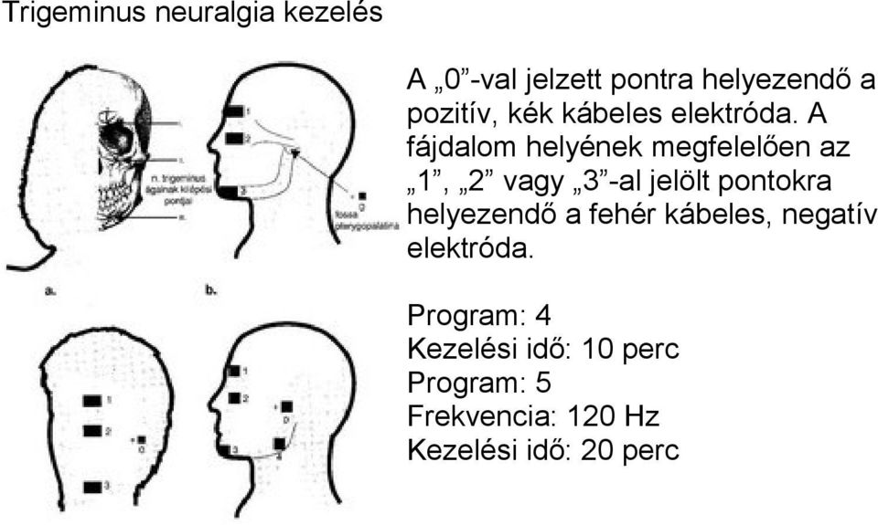 A fájdalom helyének megfelelően az 1, 2 vagy 3 -al jelölt pontokra