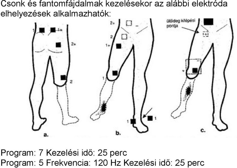 alkalmazhatók: Program: 7 Kezelési idő: 25