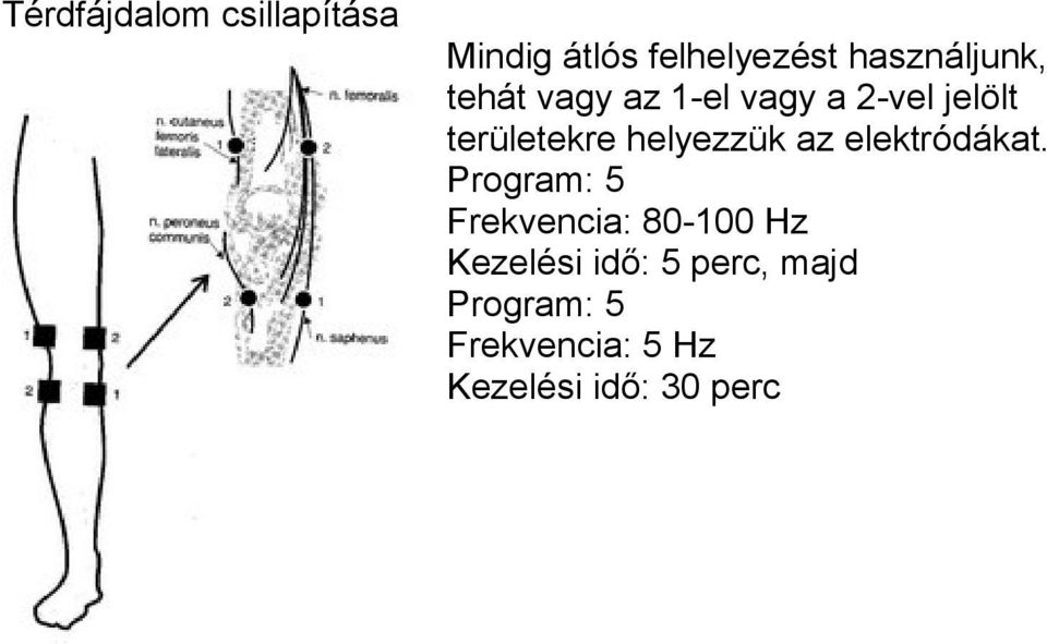 területekre helyezzük az elektródákat.