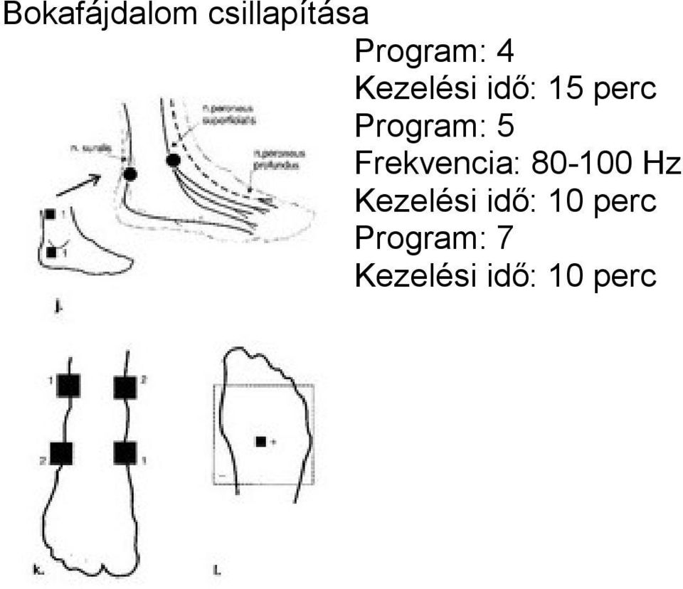 Frekvencia: 80-100 Hz Kezelési idő: