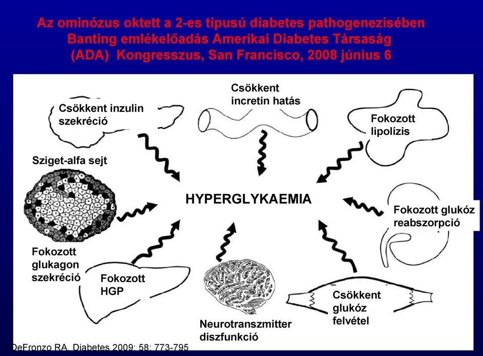 szekréció Fokozott lipolízis Sziget-alfa sejt HYPERGLYKAEMIA Fokozott glukagon szekréció Fokozott HGP