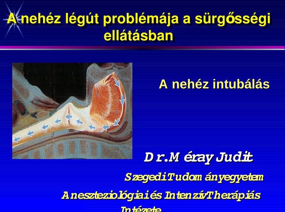 A nehéz intubálás D r.