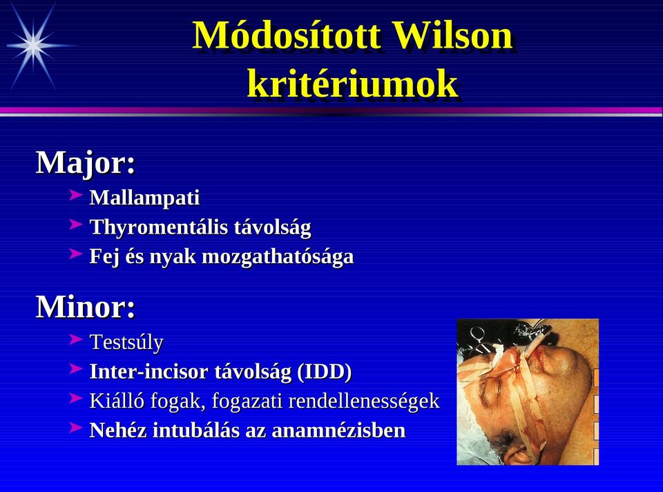 mozgathatósága Minor: Testsúly Interincisor távolság (IDD)