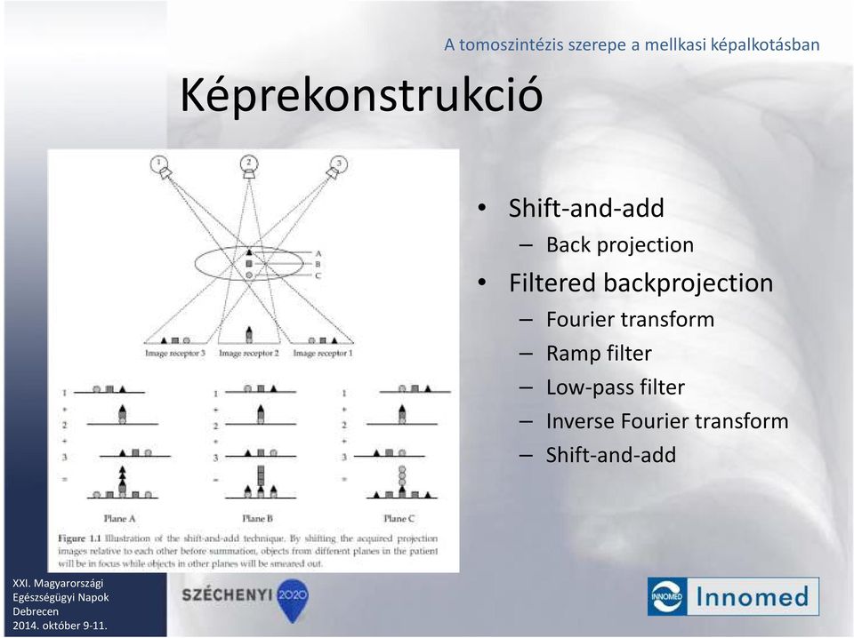 Filtered backprojection Fourier transform Ramp