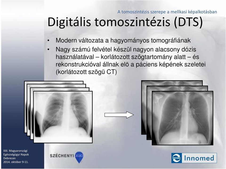 használatával korlátozott szögtartomány alatt és