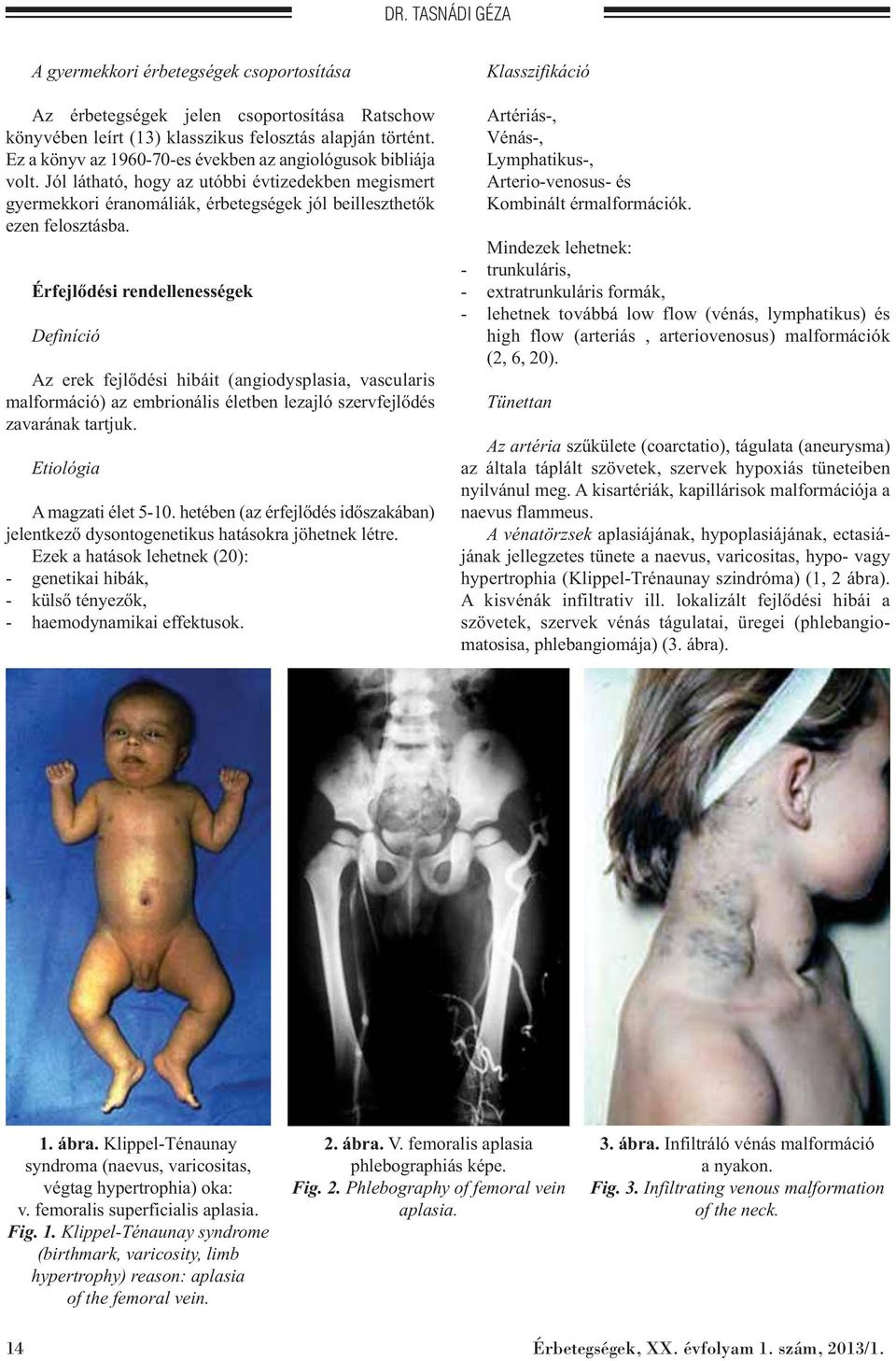 Érfejlődési rendellenességek Definíció Az erek fejlődési hibáit (angiodysplasia, vascularis malformáció) az embrionális életben lezajló szervfejlődés zavarának tartjuk. Etiológia A magzati élet 5-10.