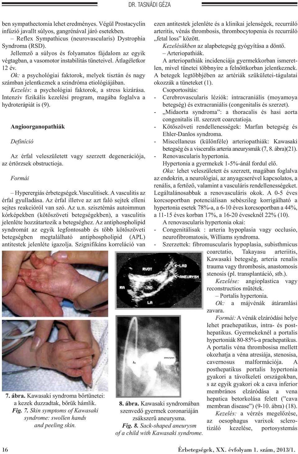 Ok: a psychológiai faktorok, melyek tisztán és nagy számban jelentkeznek a szindróma etiológiájában. Kezelés: a psychológiai faktorok, a stress kizárása.