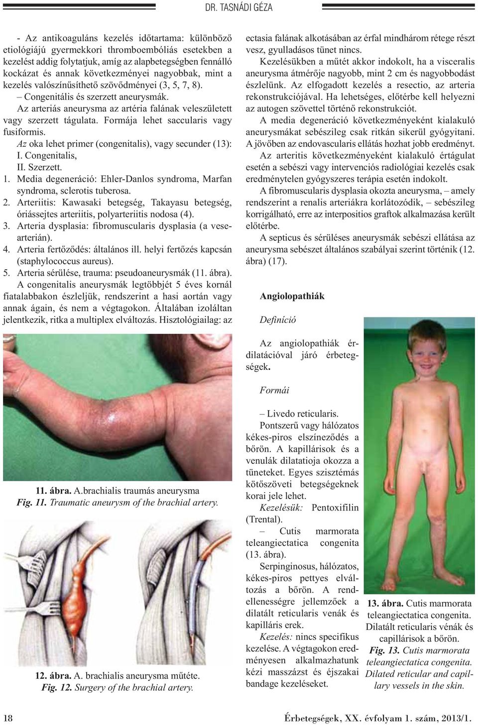 Formája lehet saccularis vagy fusiformis. Az oka lehet primer (congenitalis), vagy secunder (13): I. Congenitalis, II. Szerzett. 1.