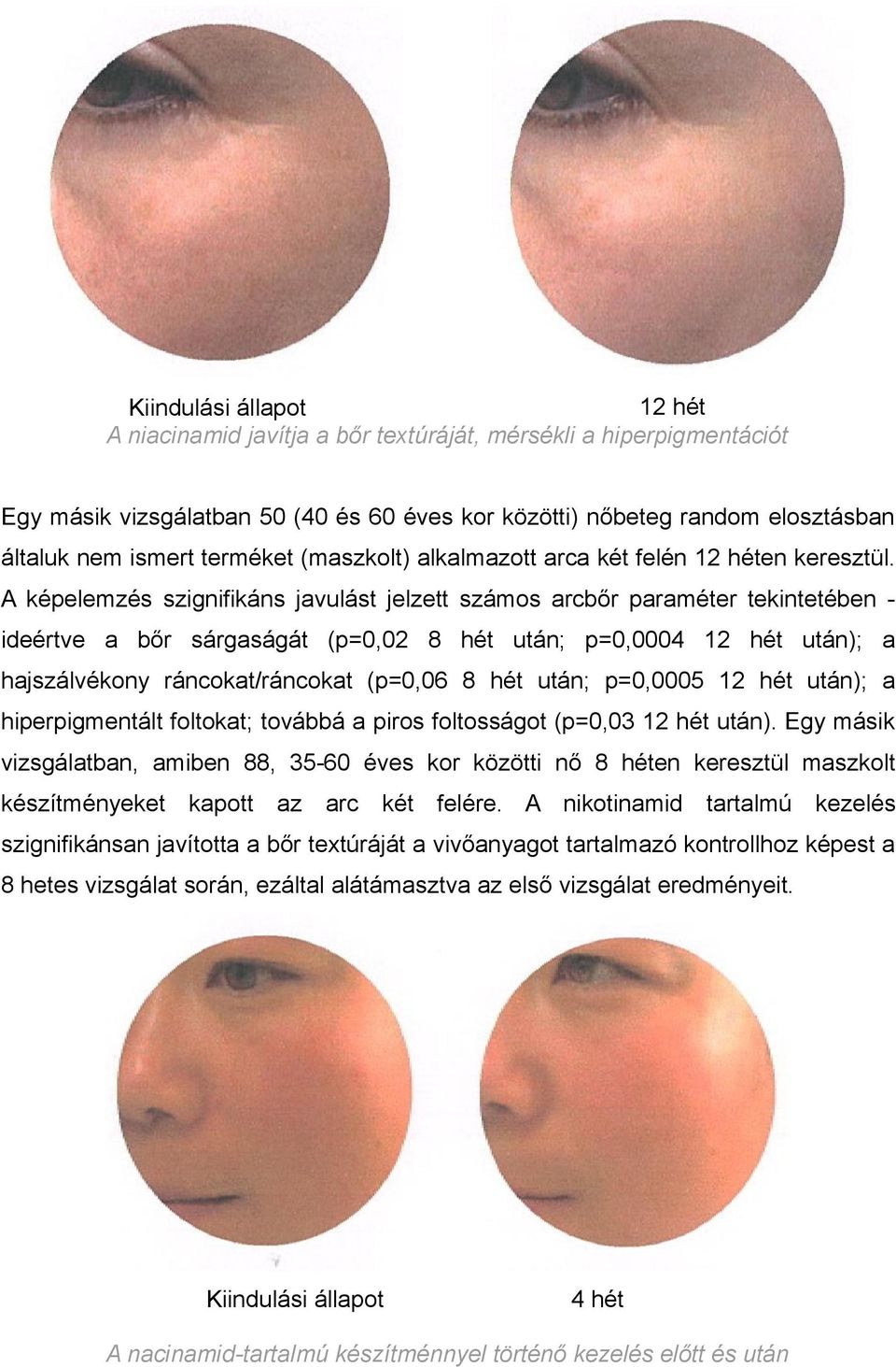 A képelemzés szignifikáns javulást jelzett számos arcbőr paraméter tekintetében - ideértve a bőr sárgaságát (p=0,02 8 hét után; p=0,0004 12 hét után); a hajszálvékony ráncokat/ráncokat (p=0,06 8 hét