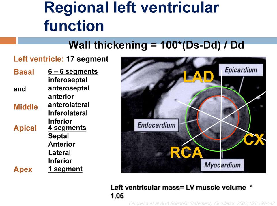 Inferolateral Inferior 4 segments Septal Anterior Lateral Inferior 1 segment LAD RCA Left