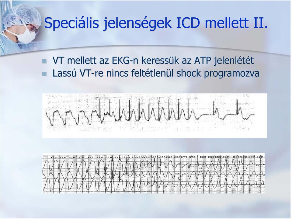 k az ATP jelenlétét Lassú VT-re