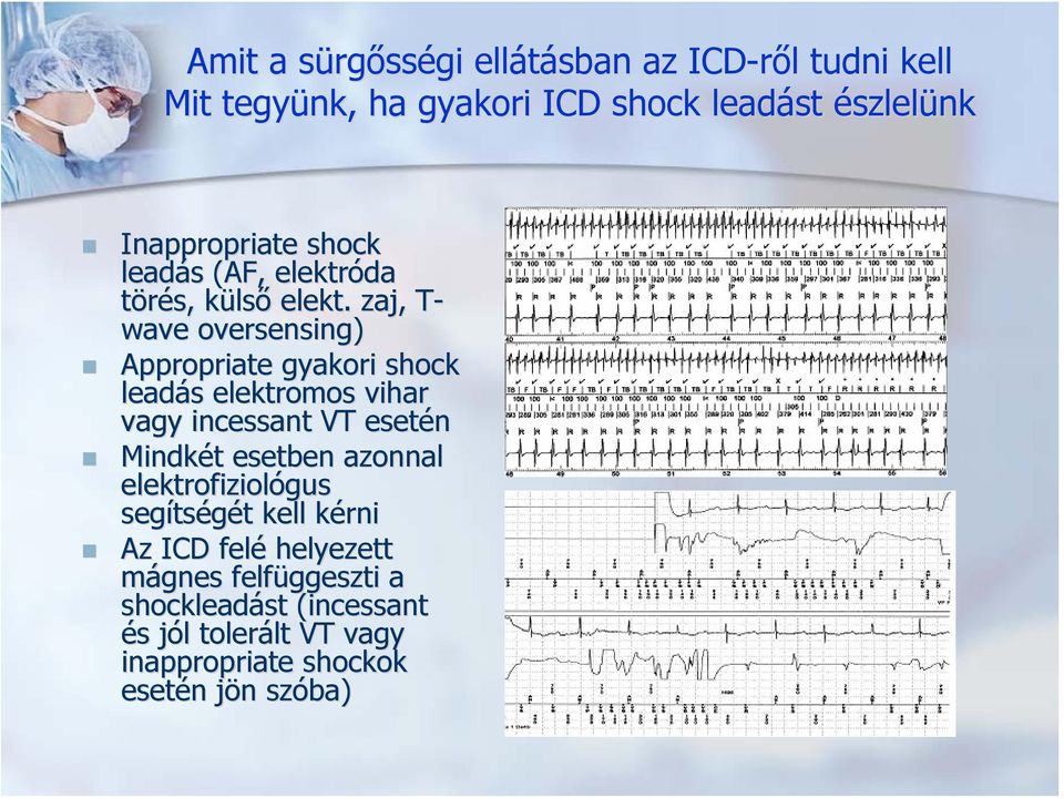 . zaj, T- wave oversensing) Appropriate gyakori shock leadás s elektromos vihar vagy incessant VT esetén Mindkét t esetben