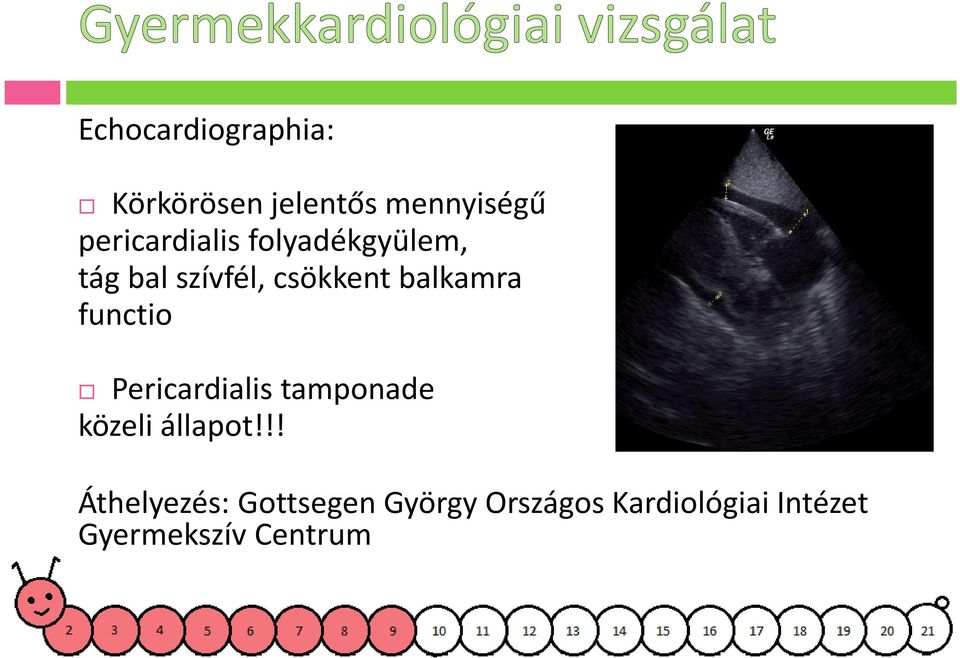 balkamra functio Pericardialis tamponade közeli állapot!