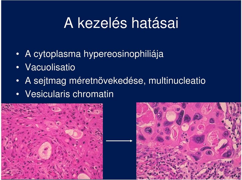 Vacuolisatio A sejtmag