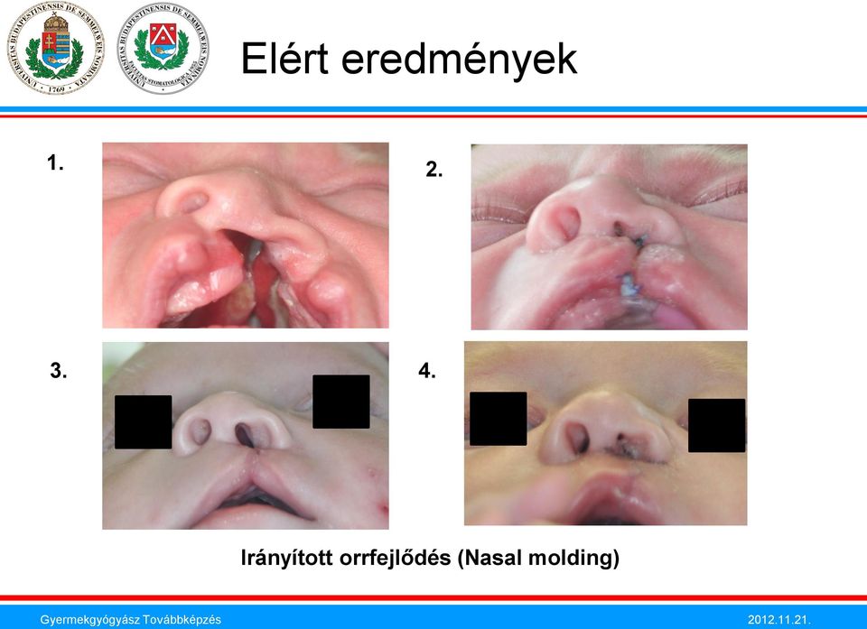 Irányított