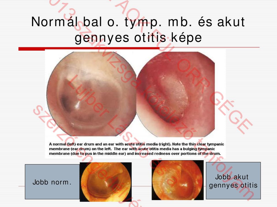 képe Jobb norm.