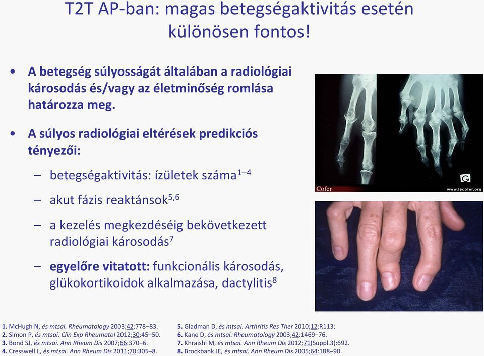 funkcionális károsodás, glükokortikoidok alkalmazása, dactylitis 8 1. McHugh N, és mtsai. Rheumatology 2003;42:778 83. 2. Simon P, és mtsai. Clin Exp Rheumatol 2012;30:45 50. 3. Bond SJ, és mtsai.