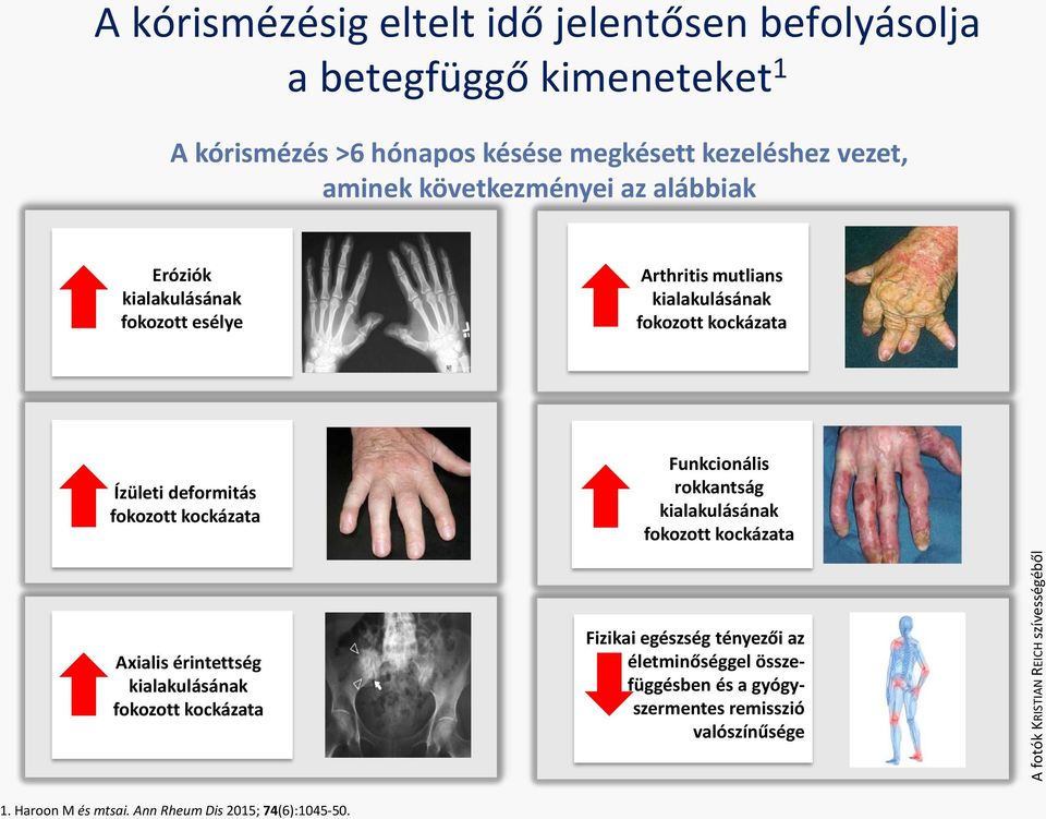 kockázata Funkcionális rokkantság kialakulásának fokozott kockázata Axialis érintettség kialakulásának fokozott kockázata Fizikai egészség tényezői az