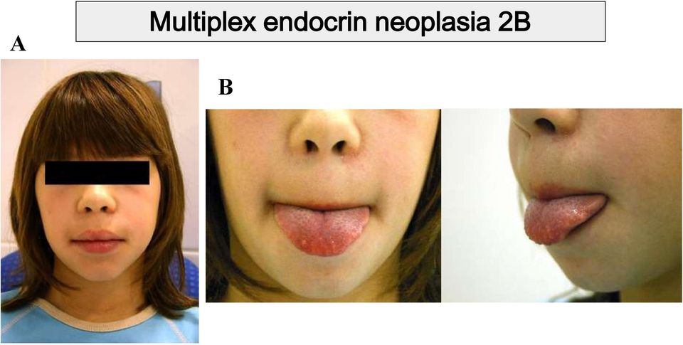 endocrin