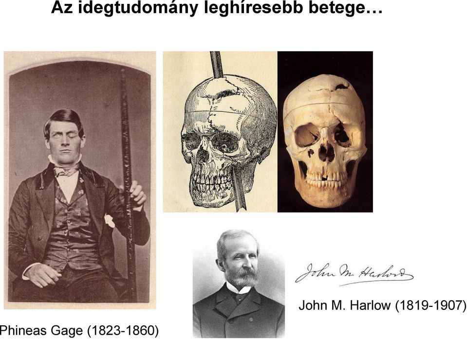 Phineas Gage