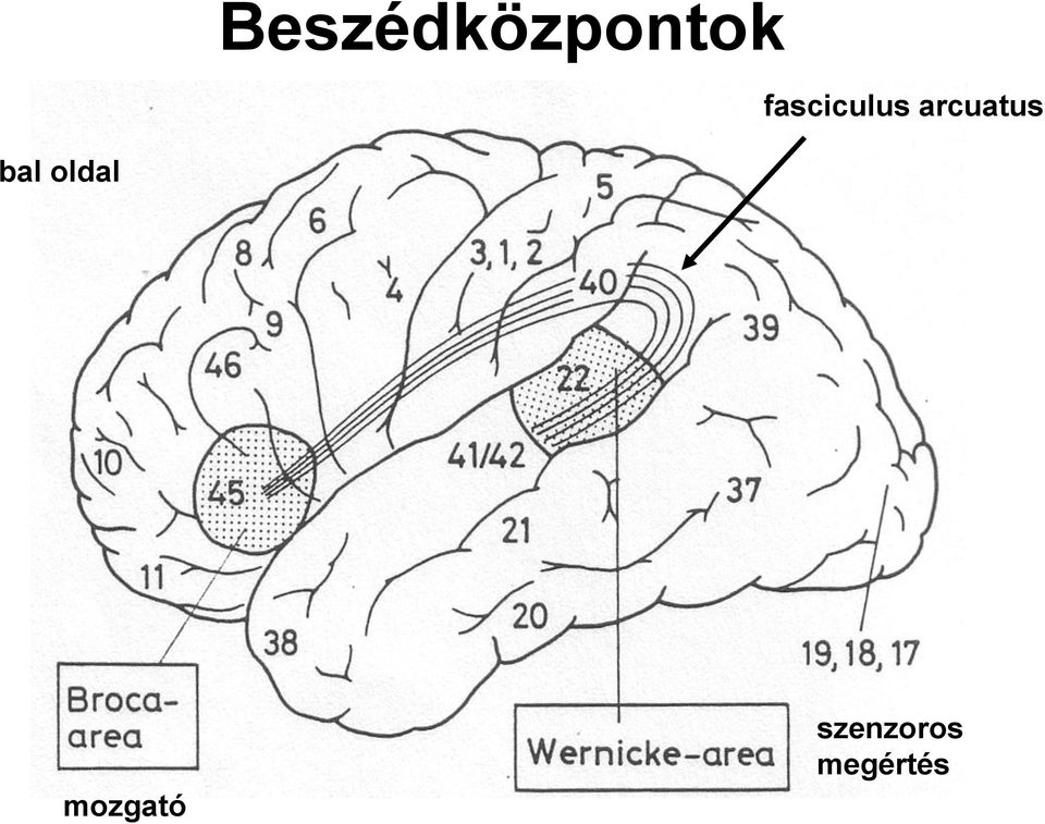 arcuatus bal