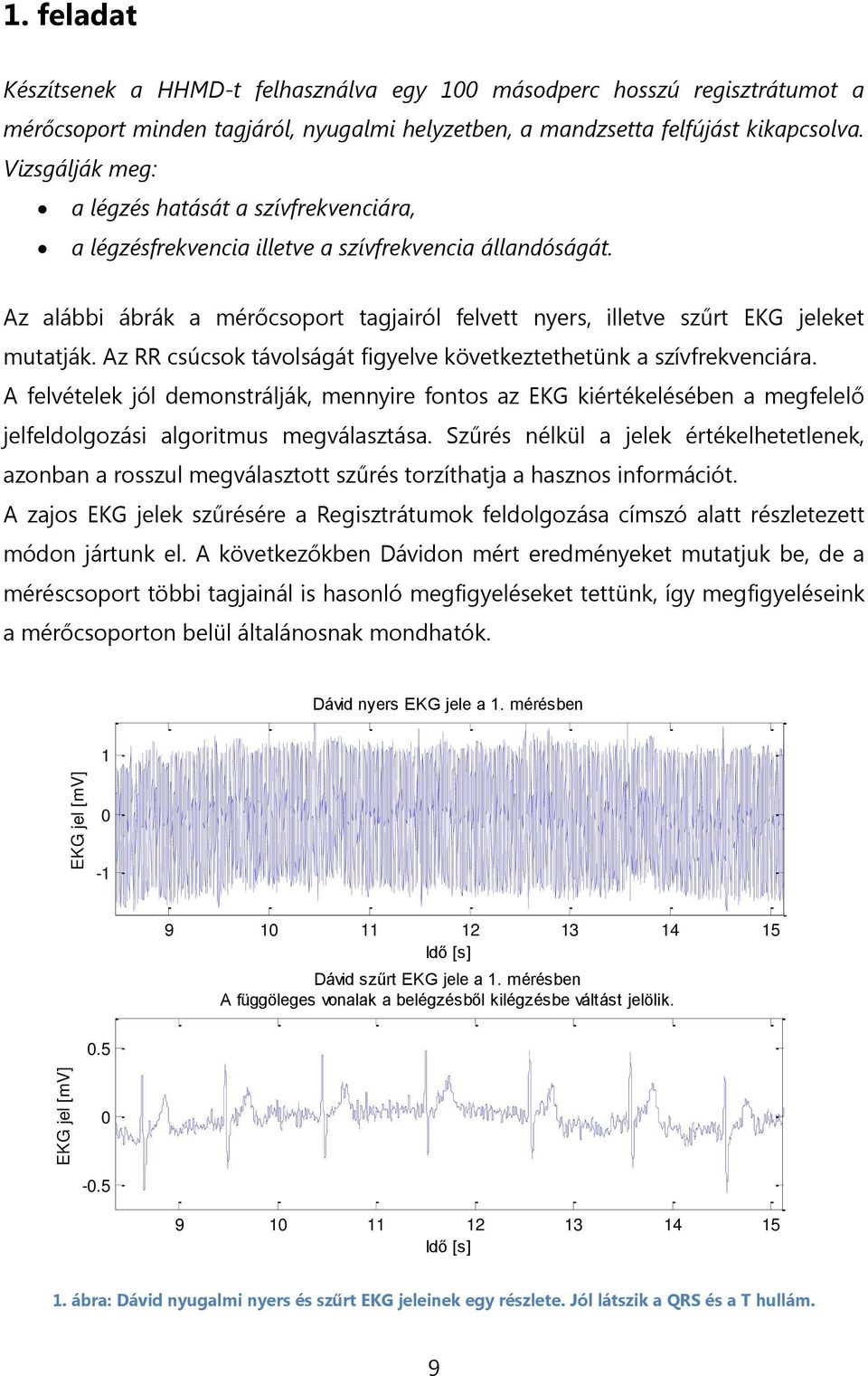 Az alábbi ábrák a mérőcsoport tagjairól felvett nyers, illetve szűrt EKG jeleket mutatják. Az RR csúcsok távolságát figyelve következtethetünk a szívfrekvenciára.