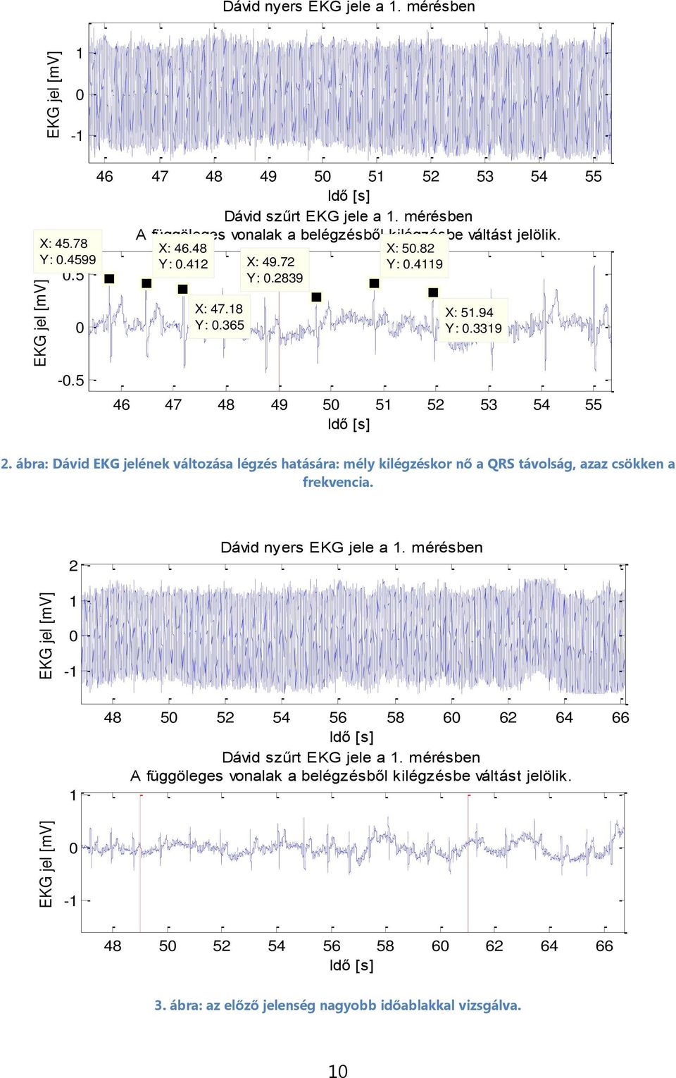 5 46 47 48 49 5 51 52 53 54 55 2. ábra: Dávid EKG jelének változása légzés hatására: mély kilégzéskor nő a QRS távolság, azaz csökken a frekvencia. 2 Dávid nyers EKG jele a 1.