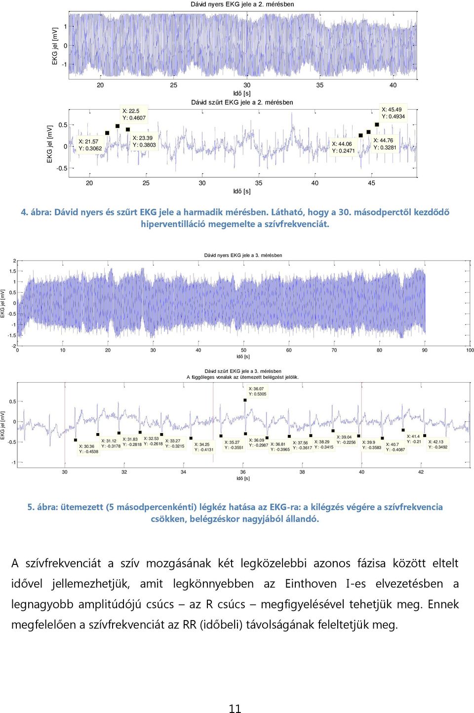 másodperctől kezdődő hiperventilláció megemelte a szívfrekvenciát. 2 Dávid nyers EKG jele a 3. mérésben 1.5 1.5 -.5-1 -1.5-2 1 2 3 4 5 6 7 8 9 1 Dávid szűrt EKG jele a 3.