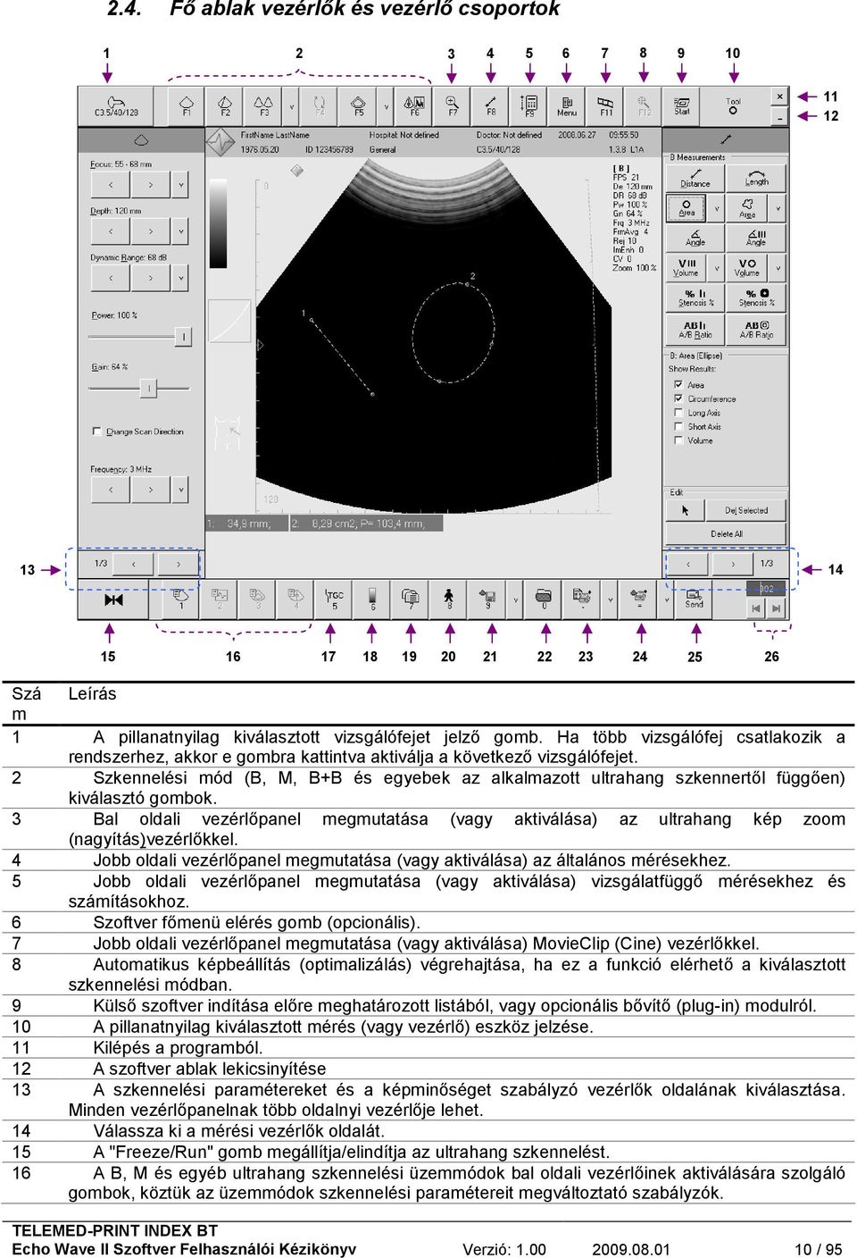 2 Szkennelési mód (B, M, B+B és egyebek az alkalmazott ultrahang szkennertől függően) kiválasztó gombok.