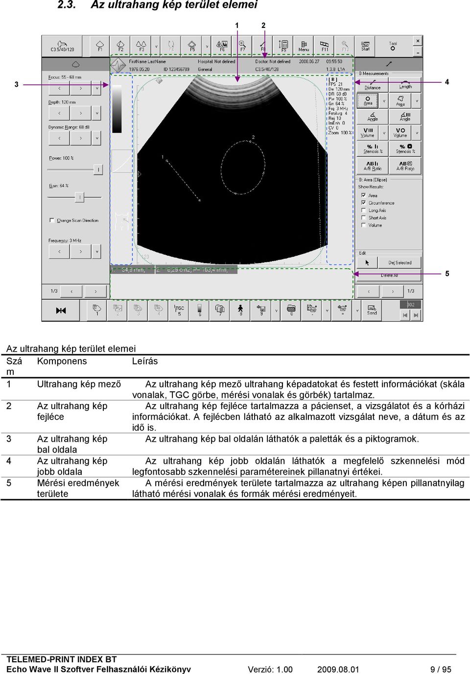 A fejlécben látható az alkalmazott vizsgálat neve, a dátum és az idő is. 3 Az ultrahang kép Az ultrahang kép bal oldalán láthatók a paletták és a piktogramok.