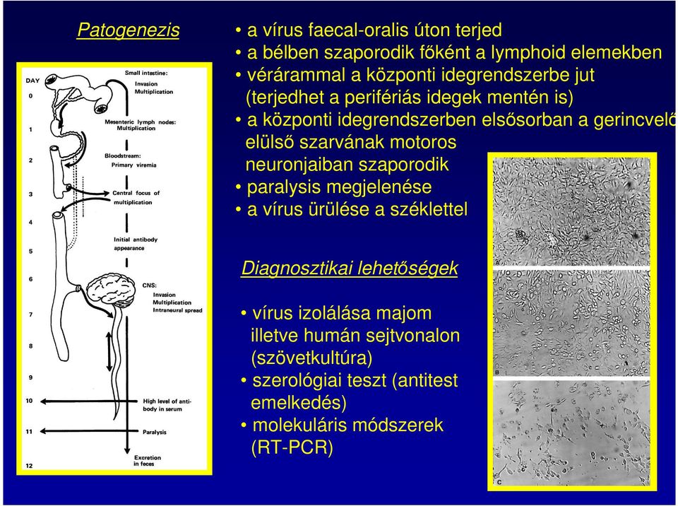 szarvának motoros neuronjaiban szaporodik paralysis megjelenése a vírus ürülése a széklettel Diagnosztikai lehetőségek