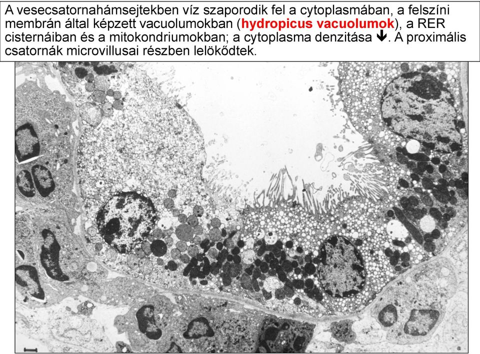 vacuolumok), a RER cisternáiban és a mitokondriumokban; a