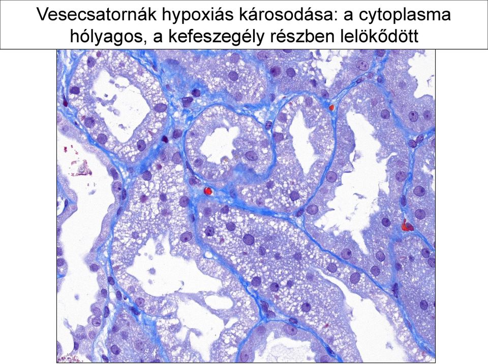 cytoplasma hólyagos, a