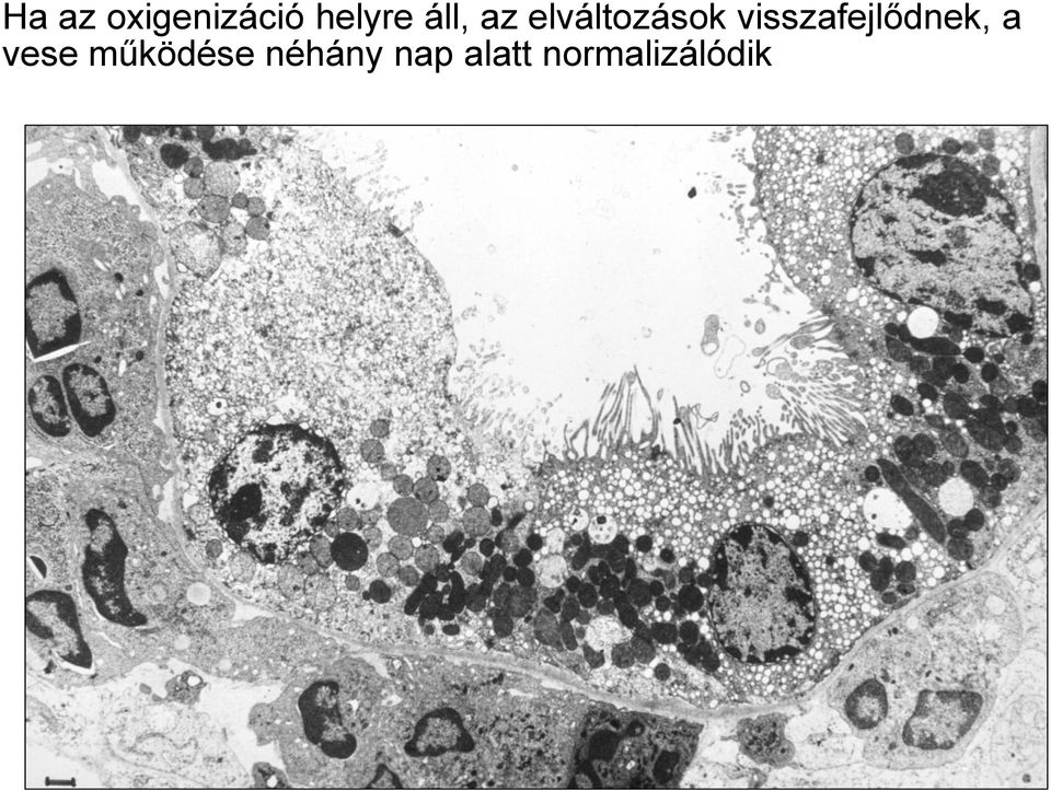 visszafejlődnek, a vese