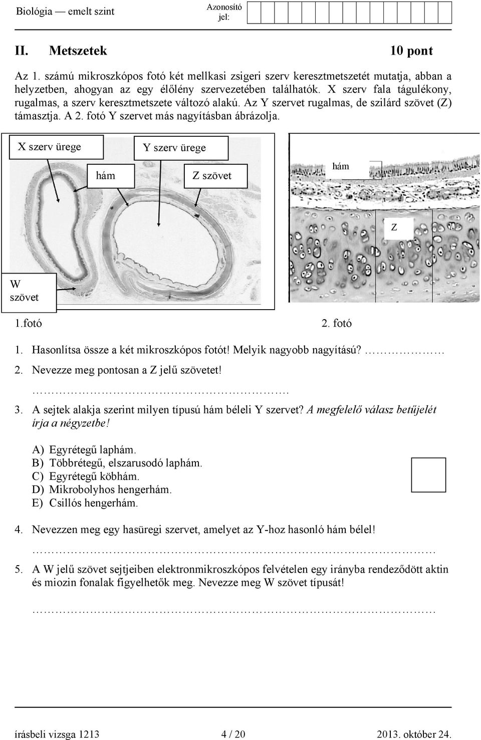 X szerv ürege hám Y szerv ürege Z szövet hám Z W szövet 1.fotó 2. fotó 1. Hasonlítsa össze a két mikroszkópos fotót! Melyik nagyobb nagyítású? 2. Nevezze meg pontosan a Z jelű szövetet!. 3.