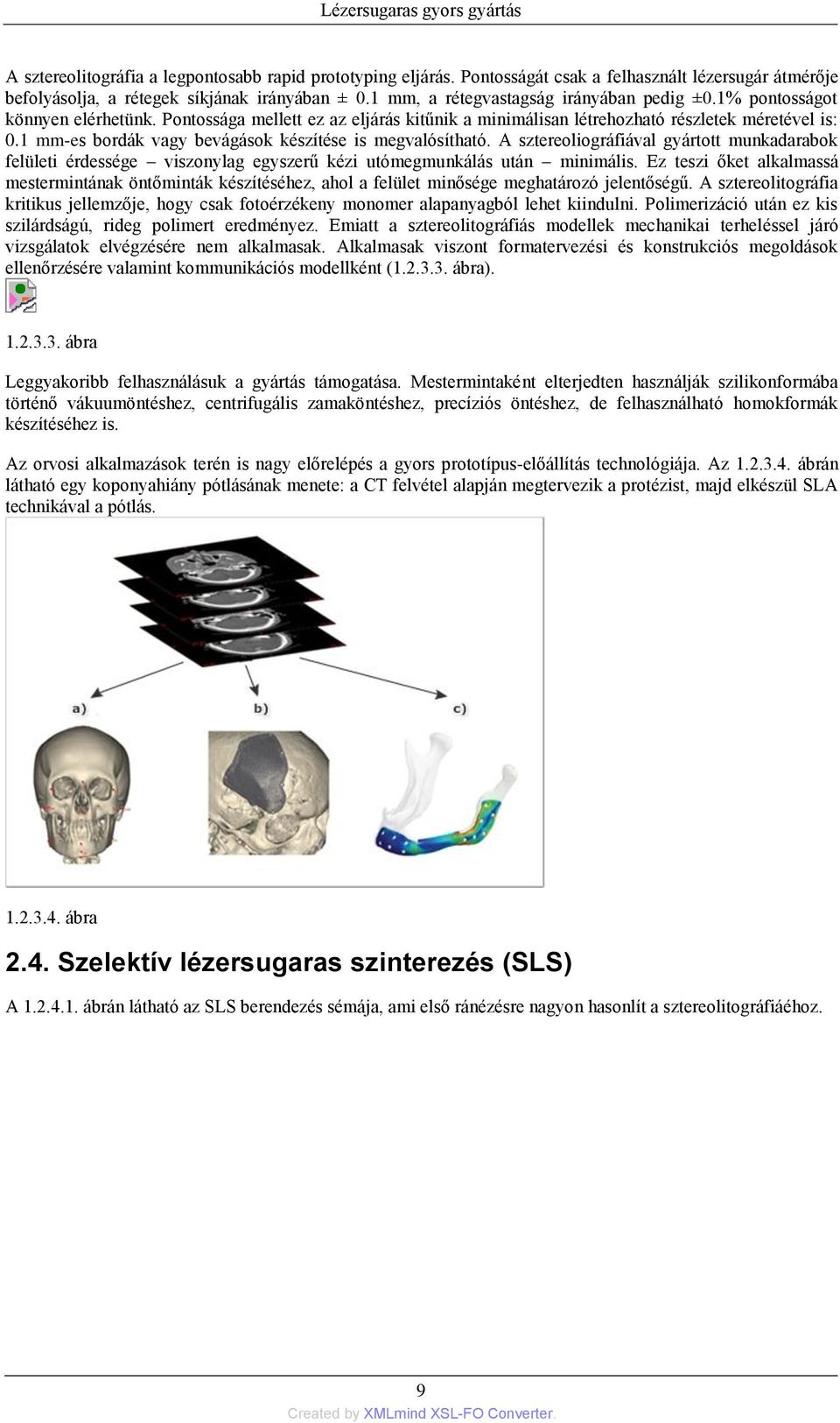 1 mm-es bordák vagy bevágások készítése is megvalósítható. A sztereoliográfiával gyártott munkadarabok felületi érdessége viszonylag egyszerű kézi utómegmunkálás után minimális.