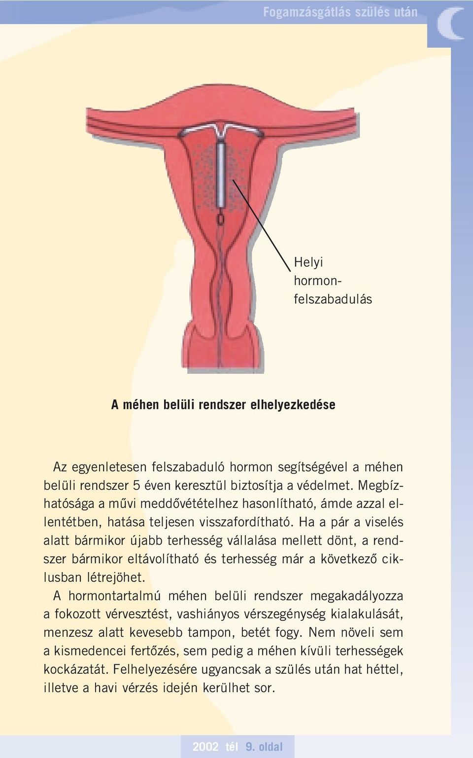 Ha a pár a viselés alatt bármikor újabb terhesség vállalása mellett dönt, a rendszer bármikor eltávolítható és terhesség már a következô ciklusban létrejöhet.