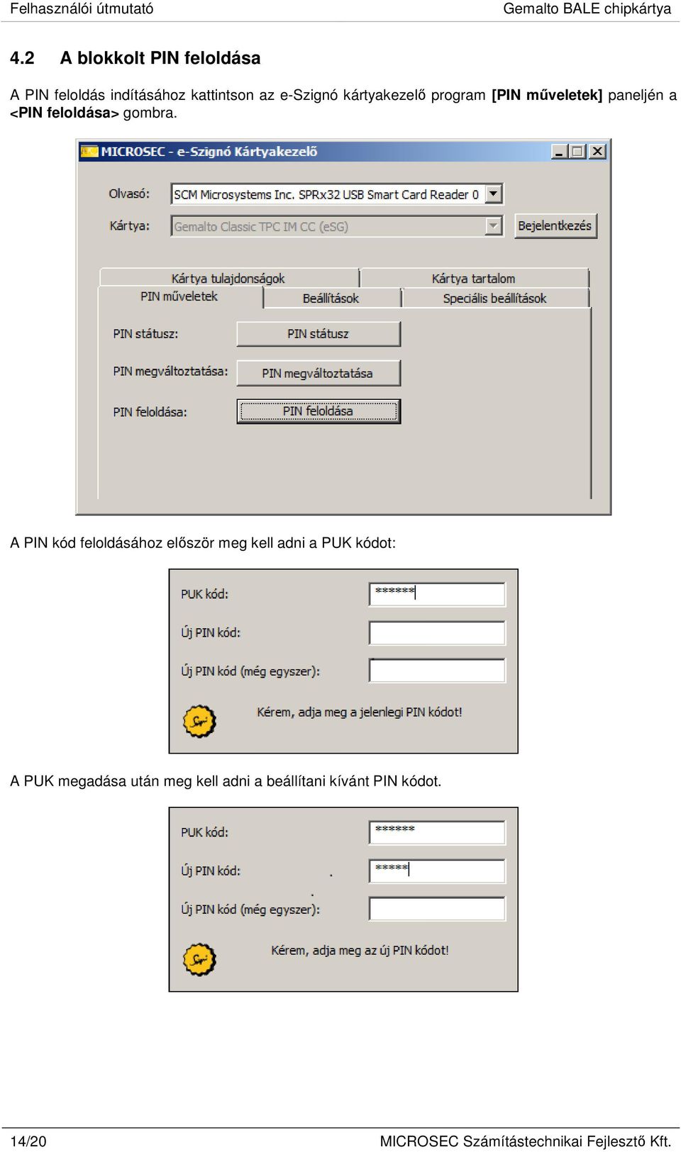 program [PIN műveletek] paneljén a <PIN feloldása> gombra.