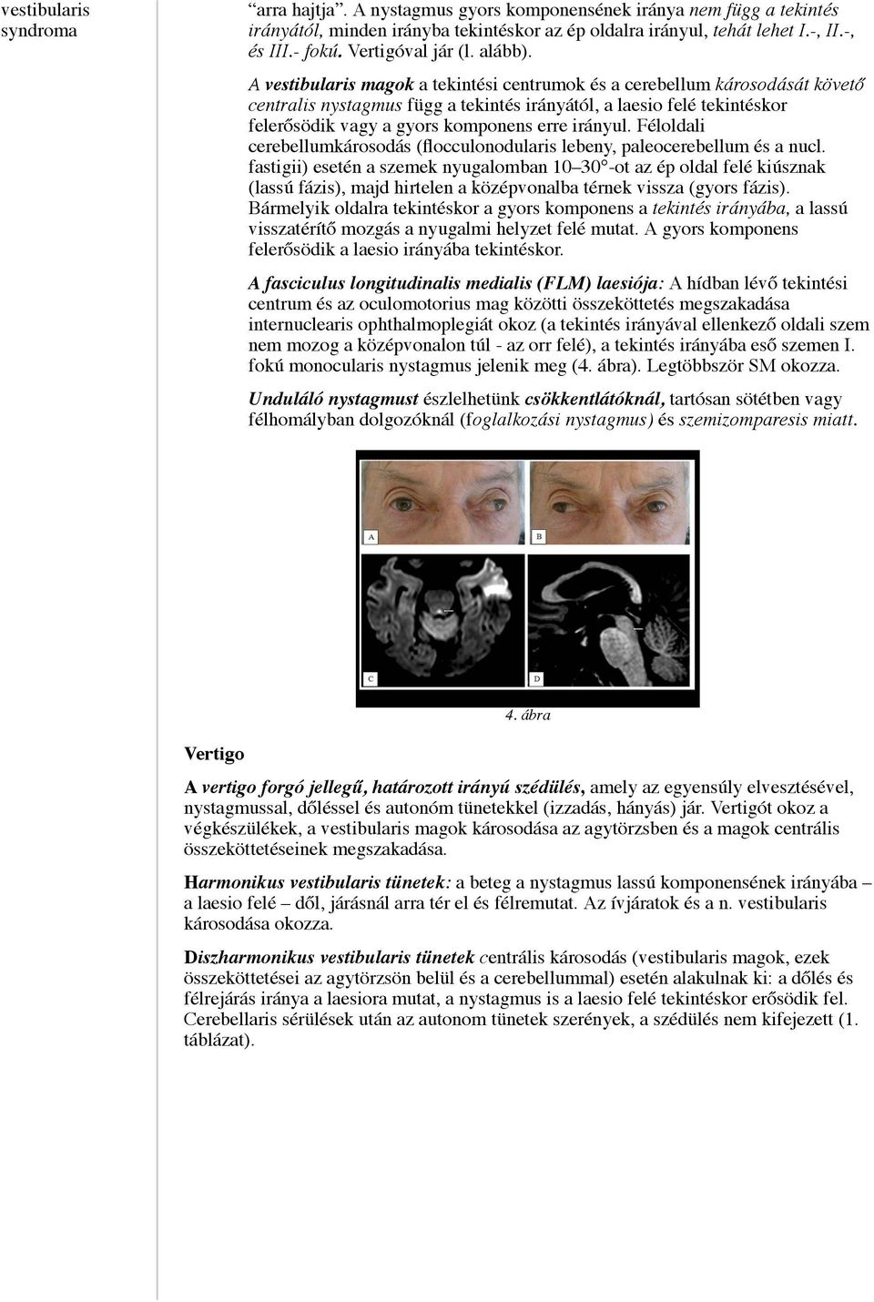 A vestibularis magok a tekintési centrumok és a cerebellum károsodását követő centralis nystagmus függ a tekintés irányától, a laesio felé tekintéskor felerősödik vagy a gyors komponens erre irányul.