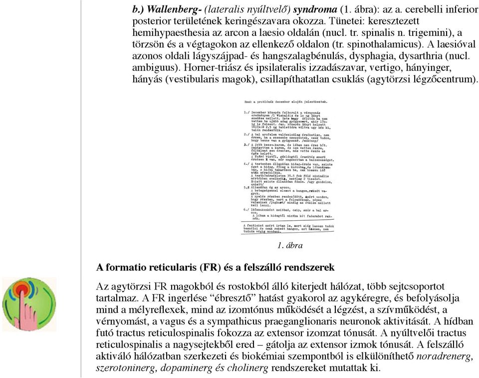 Horner-triász és ipsilateralis izzadászavar, vertigo, hányinger, hányás (vestibularis magok), csillapíthatatlan csuklás (agytörzsi légzőcentrum). 1.