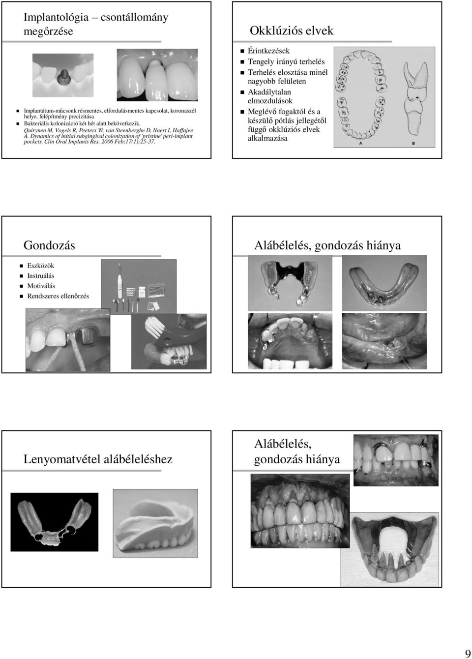 Clin Oral Implants Res. 2006 Feb;17(1):25-37.