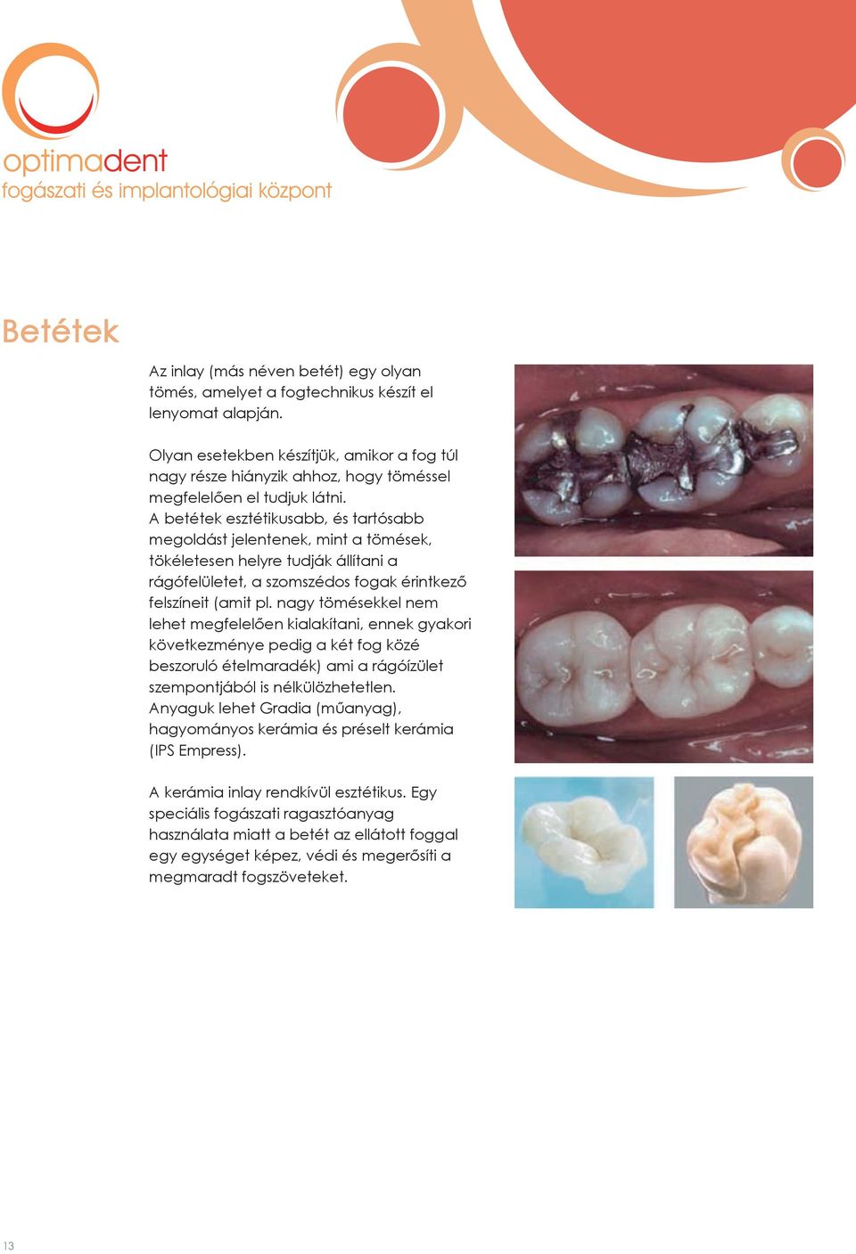 A betétek esztétikusabb, és tartósabb megoldást jelentenek, mint a tömések, tökéletesen helyre tudják állítani a rágófelületet, a szomszédos fogak érintkező felszíneit (amit pl.